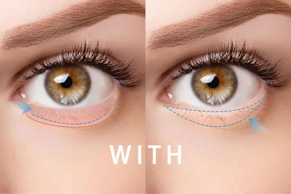 eクリニック式両側アプローチ