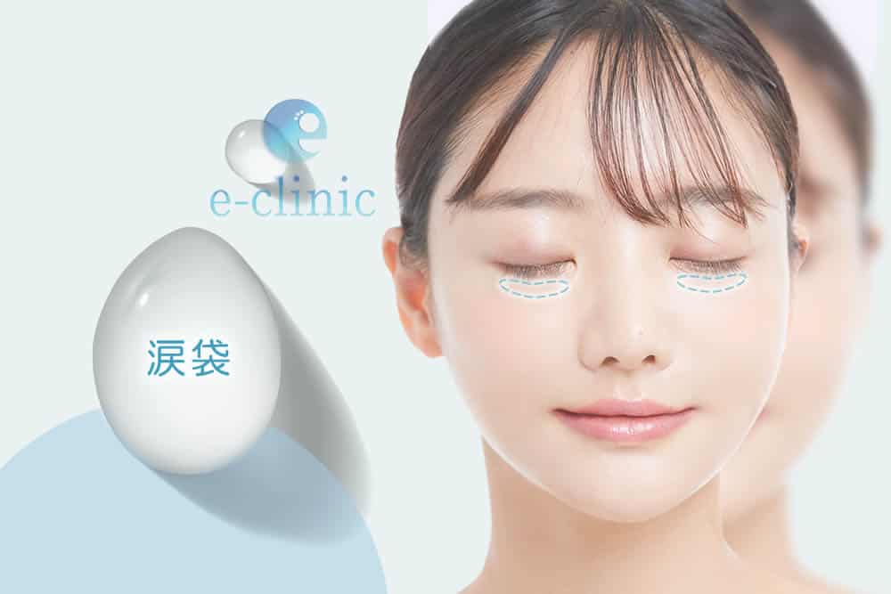 涙袋の部位
