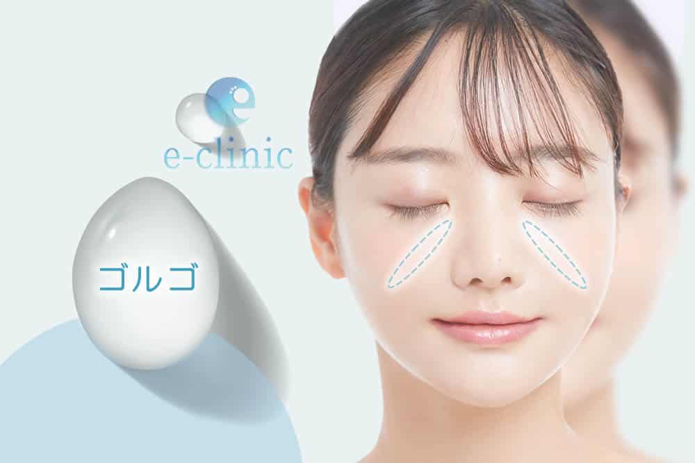 ゴルゴラインの部位
