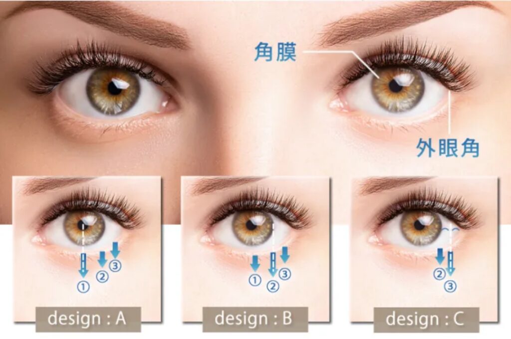 グラマラスライン形成デザインの種類