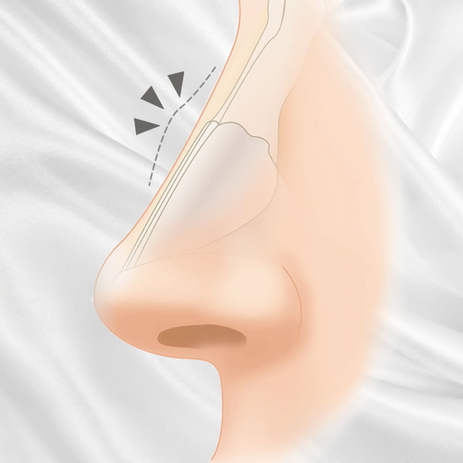 鷲鼻のイメージ