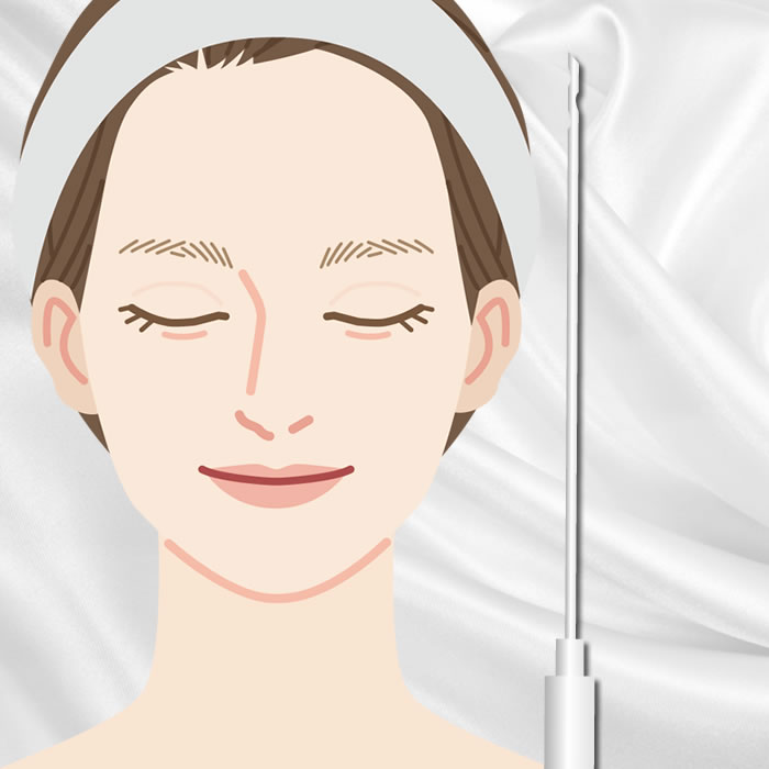 顔の脂肪吸引のアイコン