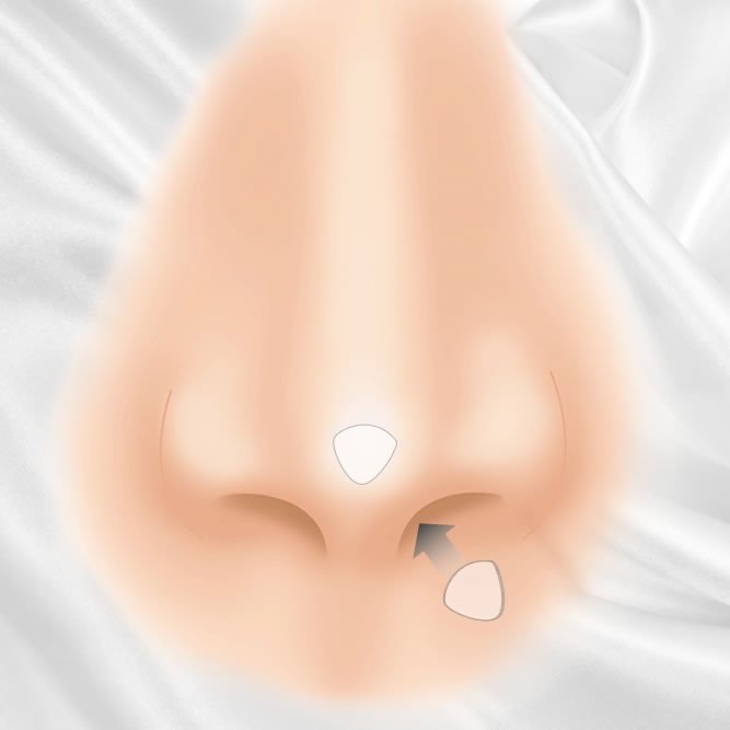 鼻尖部人工真皮のアイコン