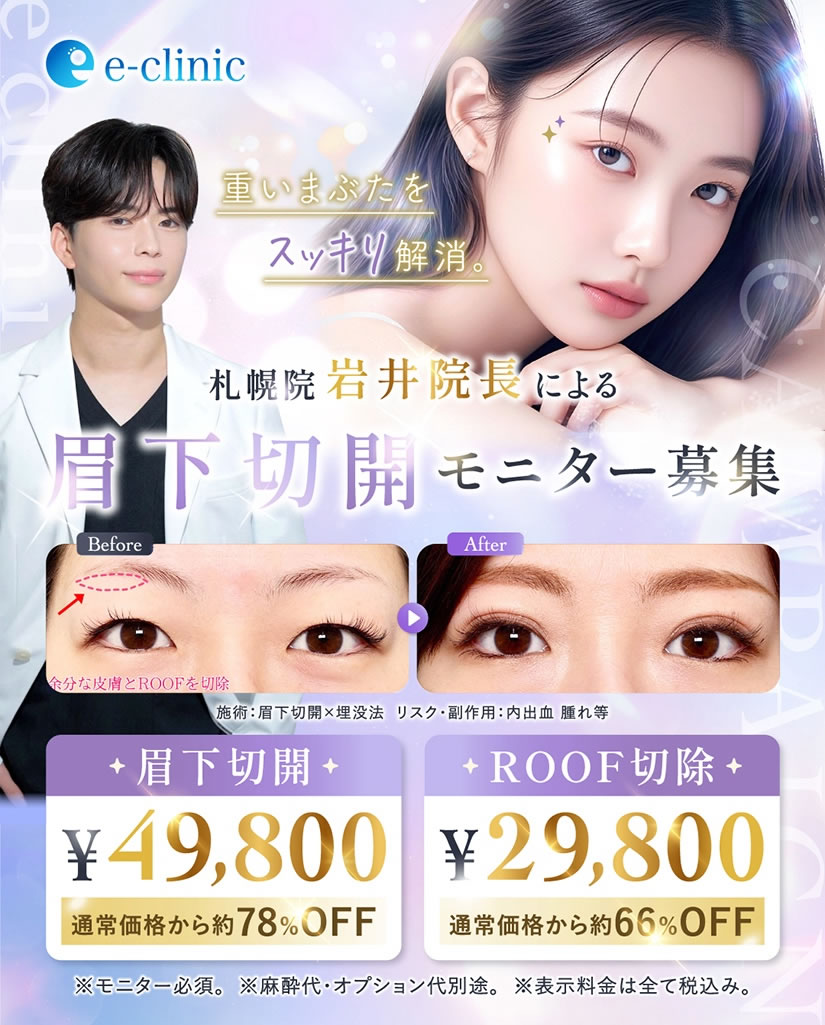 眉下切開のキャンペーンバナー