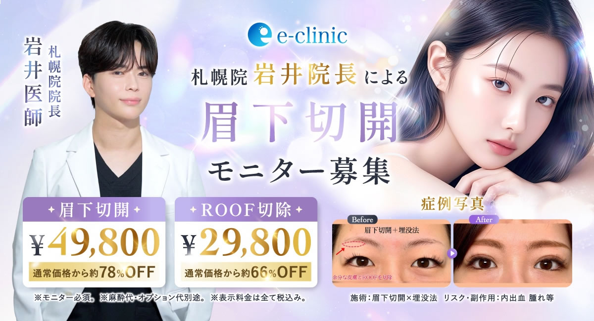 眉下切開のキャンペーンバナー