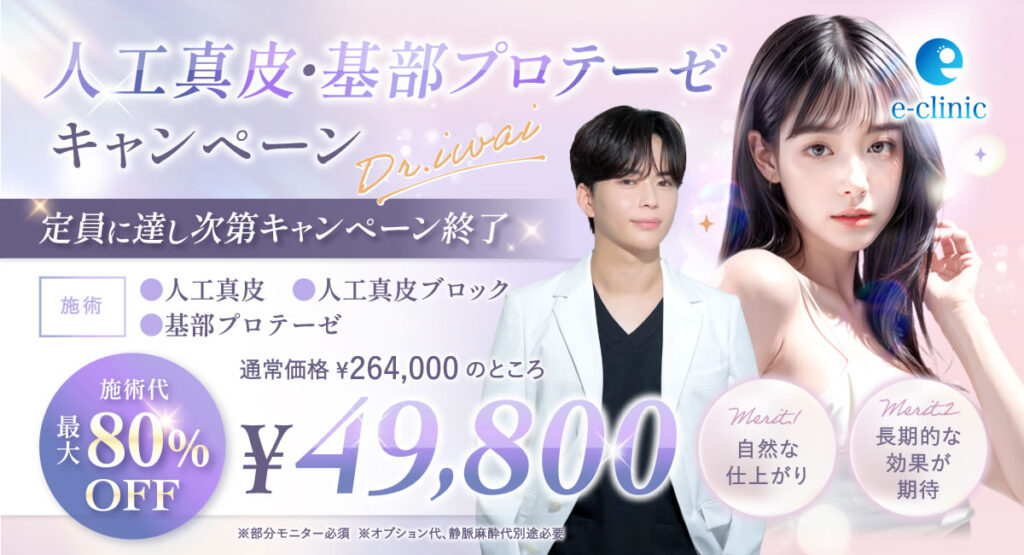 人工真皮・基部プロテーゼのキャンペーンバナー