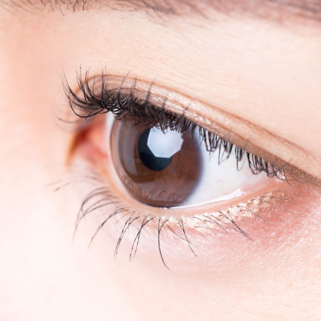 埋没法をした瞼のイメージ