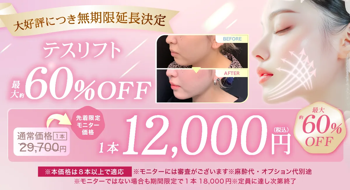 閑散期テスリフトのキャンペーンバナー