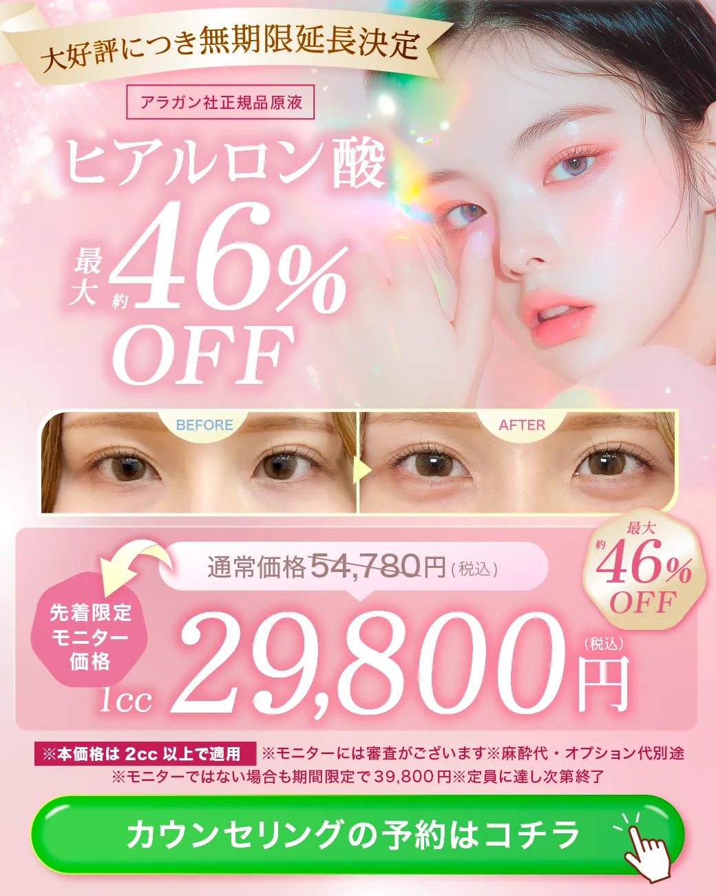 閑散期ヒアルロン酸のキャンペーンバナー