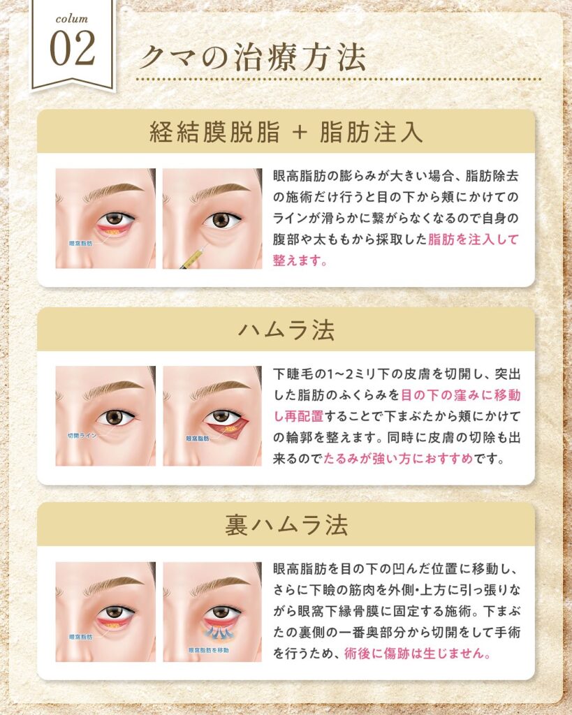 クマの治療方法の図解