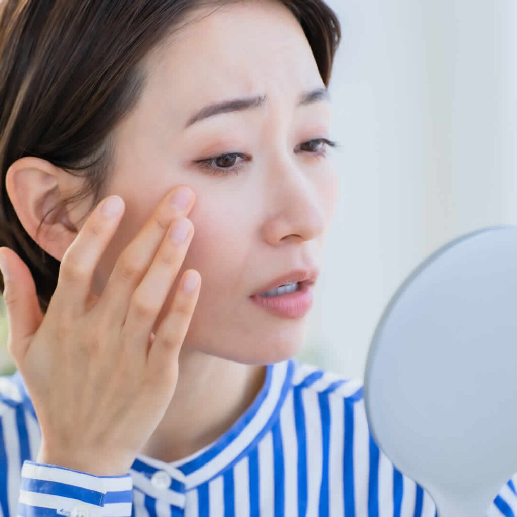 目の下の脂肪取りの経結膜脱脂を検討している女性