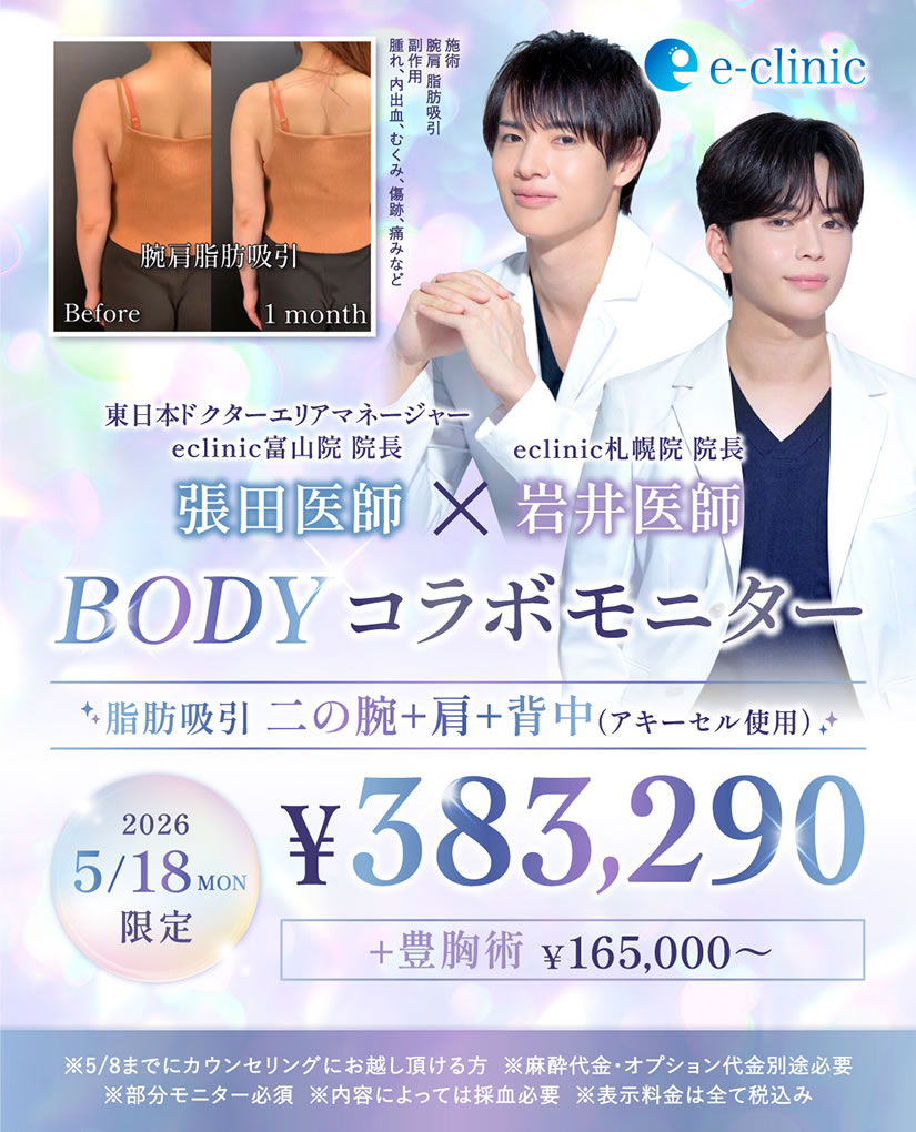 札幌院の脂肪吸引手術のモニター募集のバナー