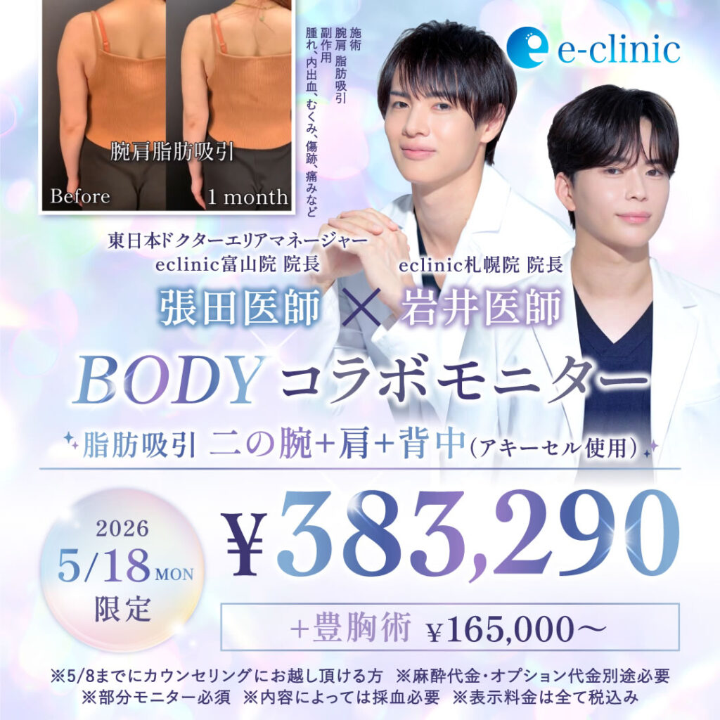 札幌の脂肪吸引のモニター募集のバナー