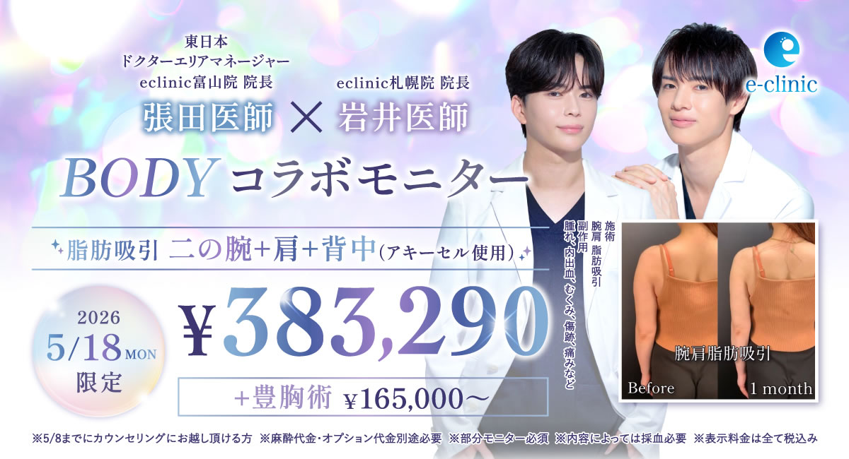 札幌院の脂肪吸引のモニター募集のバナー