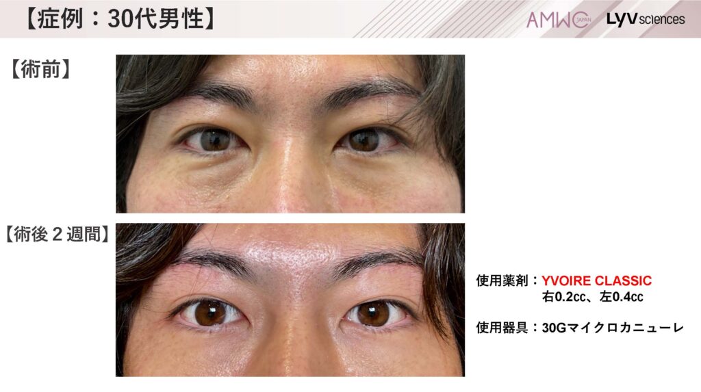 20_症例:30代男性